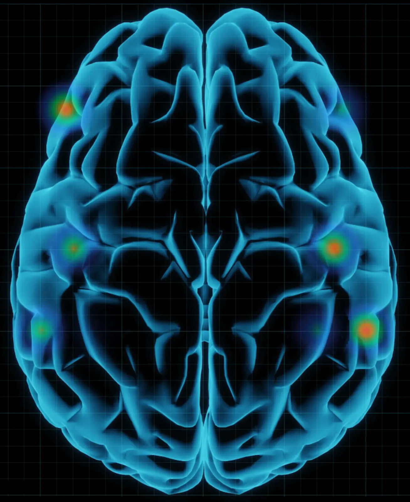 Brain Heatmap